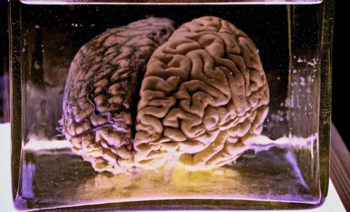 بعد أسبوع في “الموت الجليدي”… علماء يعيدون نشاط الدماغ للحياة