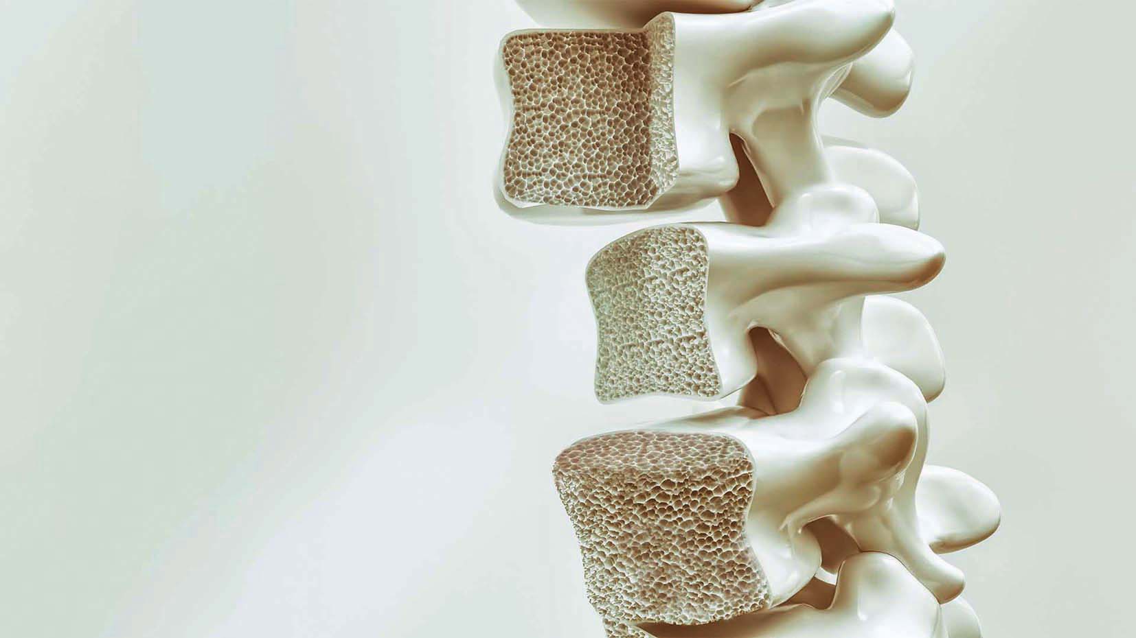 جامعة بازل تعلن عن تقنية جراحية مبتكرة لعلاج هشاشة العظام وآفات غضروف الركبة