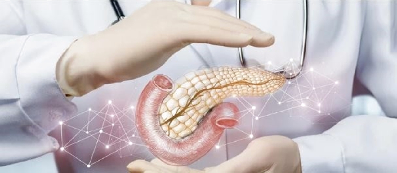 باحثون يستخدمون 'العضيات' لاكتشاف علاج لسرطان البنكرياس