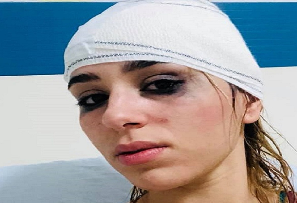 رمزي هل تعلم: يتسبب في حادث خطير لنرمين صفر