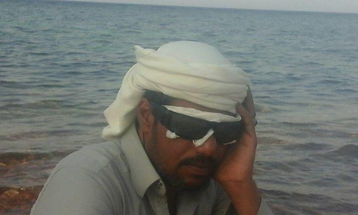 اقتلعوا عينيه لإجباره على تطليق زوجته!