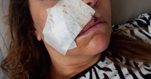 الحمامات : القبض على مجرم قام بعملية براكاج شنيعة في حق أستاذة جامعية اصيلة ولاية الكاف