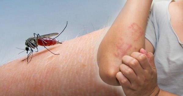 تونس : وزارة الصحة تحذر من بعوضة النمر الخطيرة