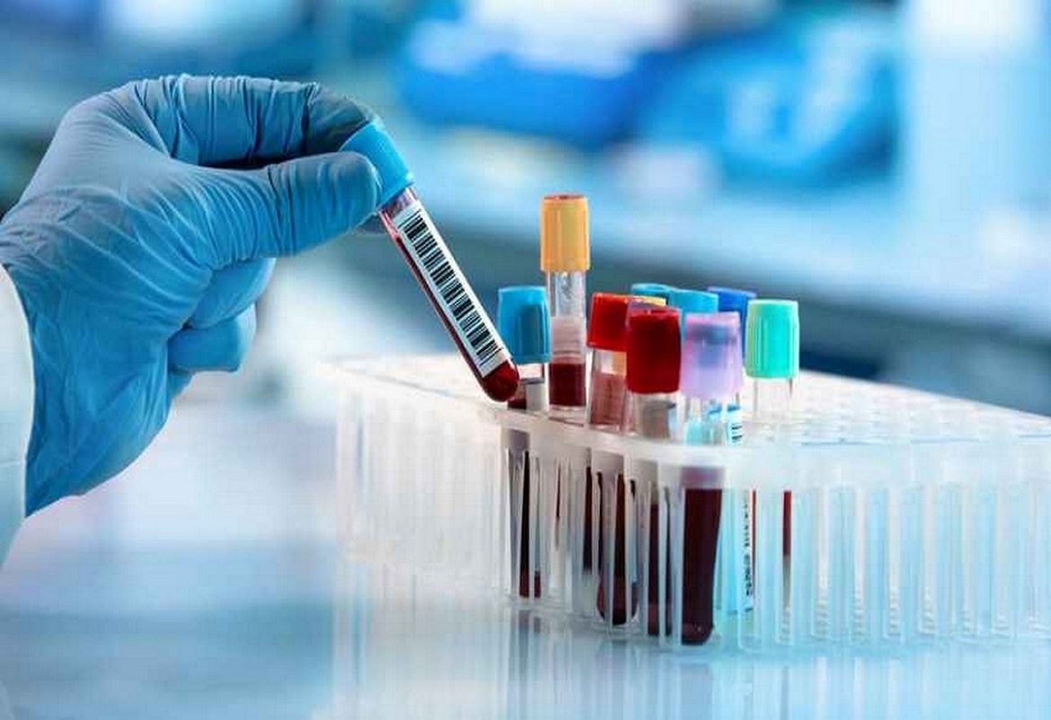 ابتداء من اليوم.. اجراء 2000 تحليل سريع لتلاميذ الباكالوريا و الأساتذة