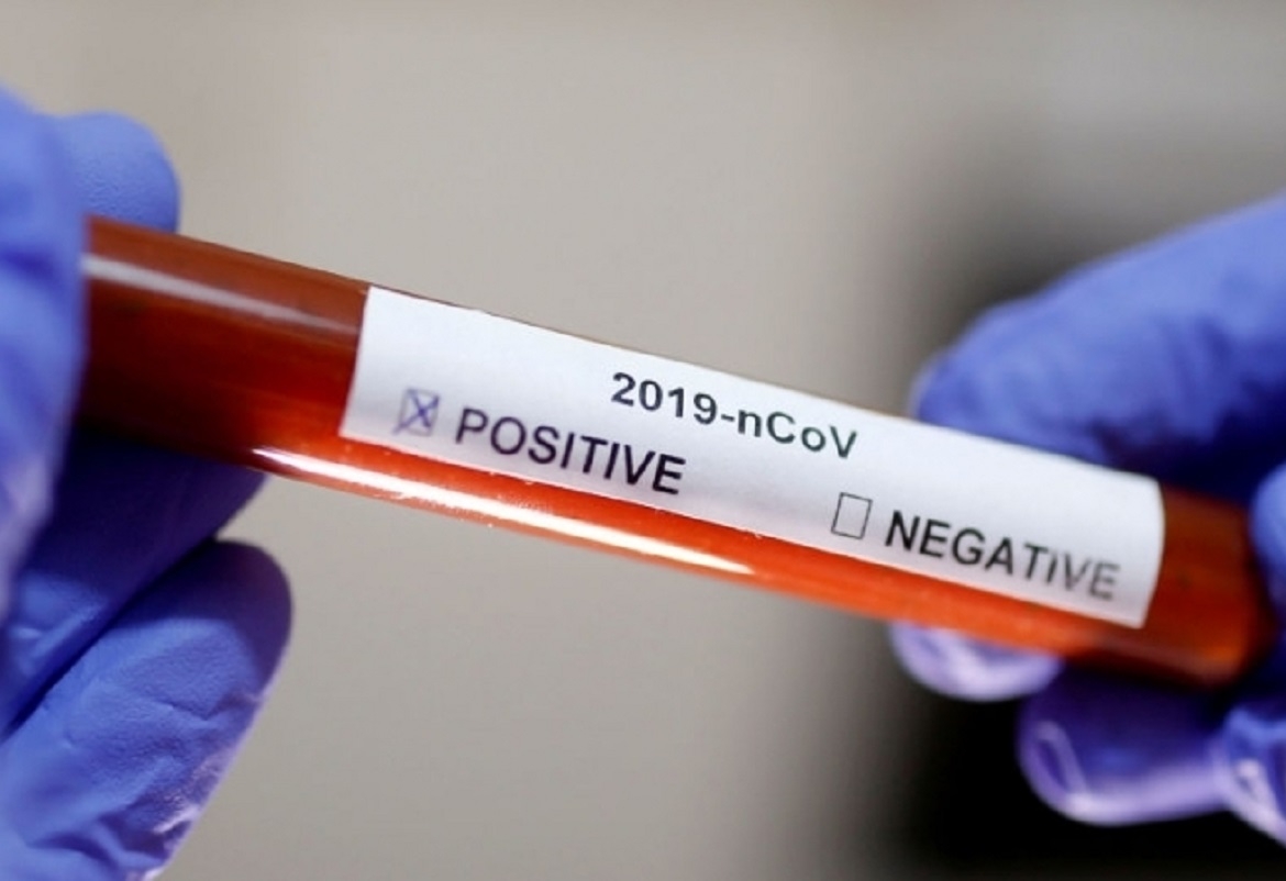 اليوم: طرح أول جرعة من لقاح تجريبي ضد فيروس كورونا